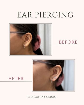 Ear Piercing Before and After